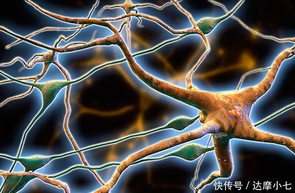 聪明|老年痴呆测试:我在这张图片中发现了3个字,聪明的你找到几个?