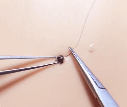 手术|给火龙果割阑尾33岁水果医生爆红吸粉90万网友看到第一个就痛了