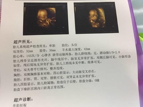 怀孕后，这2项孕期检查千万别忘了做，关系到胎儿健康！