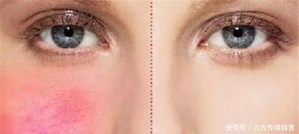 不洗脸真的能让皮肤变好吗?