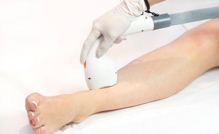 腿毛|为啥有的女生体毛旺盛，而有的“光秃秃”？哪种更健康？不妨了解