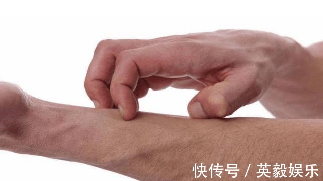 肝癌患者|肝癌多是“拖”出来的身体出现“2痒2痛”,查下肝功能