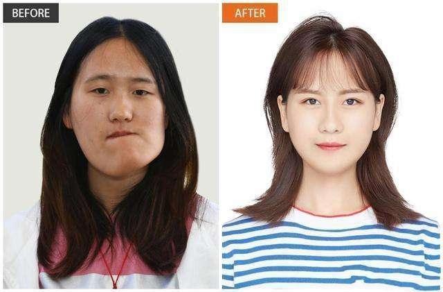 整容|歪脸女孩整容逆袭成女神,舍百万年薪当老师,这才是整容的意义