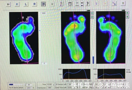 测试|做完这个测试，发现自己根本不配跑步！！！