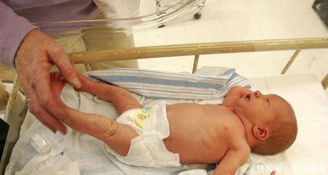 孩子|宝宝身上长“黑刺”,妈妈嫌难看一根根拔掉,第二天直接送医院!