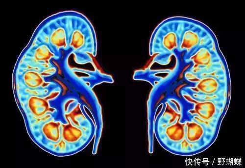 肾小管|45岁男子查出尿毒症,需终生透析,医生:两件事做得“太多”了