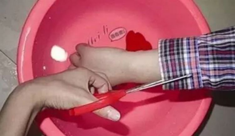 孩子|孩子烫伤身体,先脱衣服还是先冲水?一步做错,孩子伤情更严重