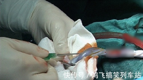 家长们|脐带血=救命血?伴随孩子降生的这份“礼物”,到底要不要留存?