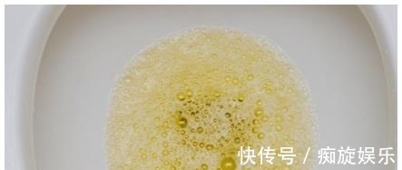 糖尿病|上厕所后，出现3种情况，说明血糖高了！糖尿病患者要留心