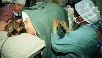 二胎|头胎剖腹产,第二胎继续剖,到底有多痛这些有经验的宝妈这样说