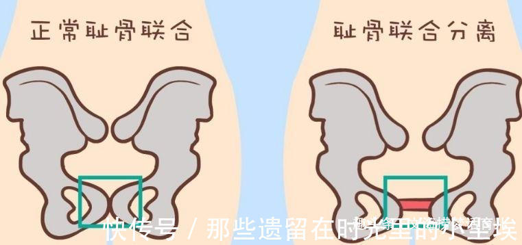 走过花开的石林|产后恢复女人生完孩子后,如何快速收盆骨防止大肚腩