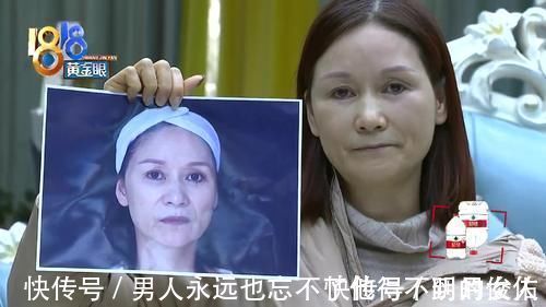 效果|13万花在脸上 效果不满意 美容医院:不是把50岁做成18岁