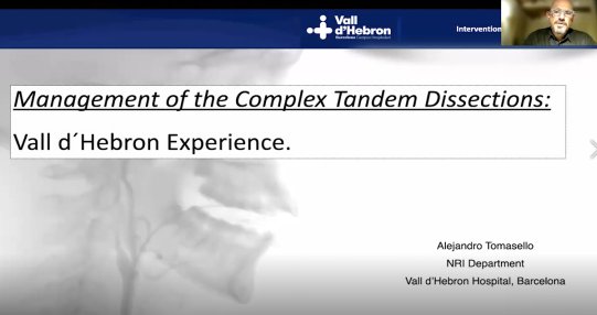 神经内科|山东省医师协会神经内科介入医师分会2021学术年会暨第十二届泰山脑血管病介入治疗会议成功召开