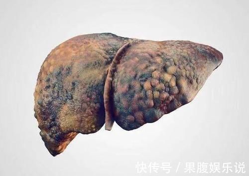 甜枣|医生提醒：肝不好的人，平时少食用这3种水果，若你爱吃建议节制