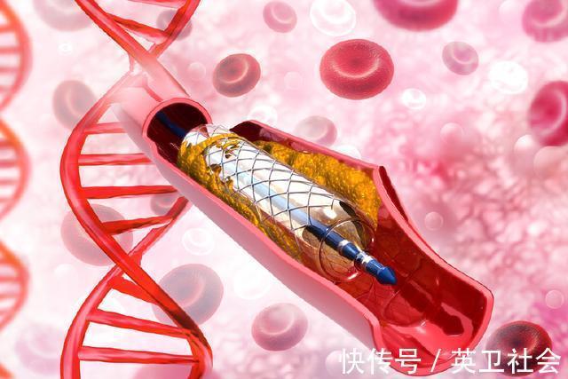 血栓|人体能自动消除血栓！做到5件事，净血液，血栓不“添堵”