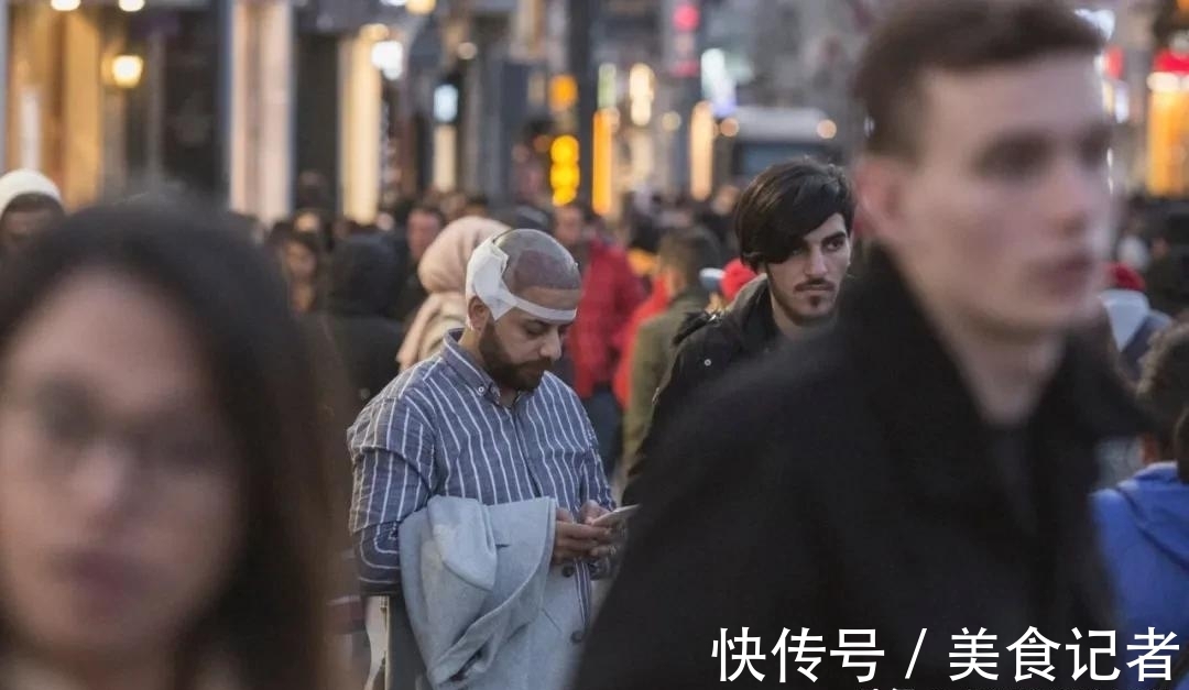 chris 每个月到底有多少人去土耳其植发?