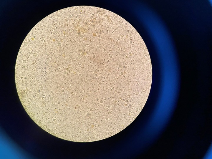 何丽娜|4岁孩子连着狂吐两天还水米不进,最后医生在便便里找到这种虫子