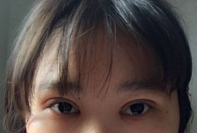 美女|曾经那些割了双眼皮的美女,10年后会变啥样,看完还敢割吗?