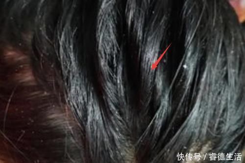 头发应该多长时间洗一次别再傻了,难怪你的头发掉得这么快