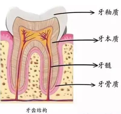 牙髓炎|牙齿反复痛后又不痛了，是自愈了吗？口腔医生告诉你不可能