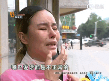 張檬|又是饅頭臉!婁藝瀟張檬孫菲菲,被玻尿酸害了的,還不止這些