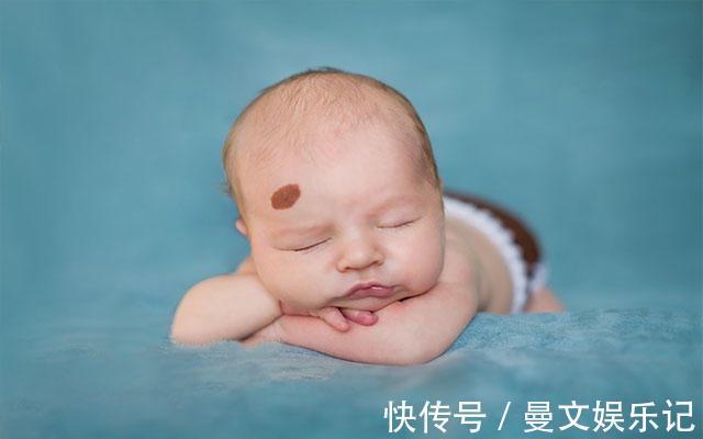 血管瘤|要想宝宝出生后不长胎记,孕期避免这几件事就OK,你做到了几条