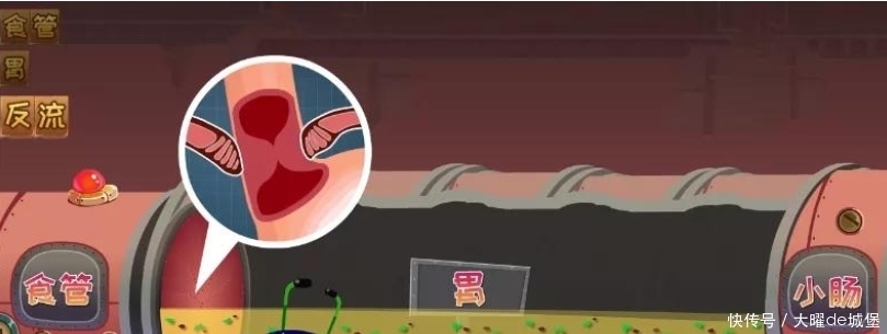 胃食管反流咋回事?反酸烧心背后真相是啥?胃食管反流发病机制