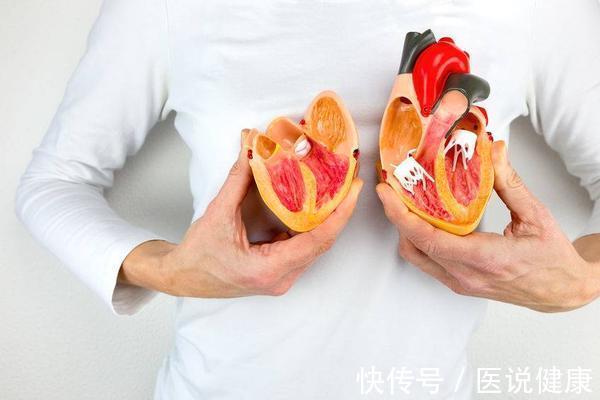 心衰|身体出现这4种情况,或是心衰找上门了,需留心观察,及时检查