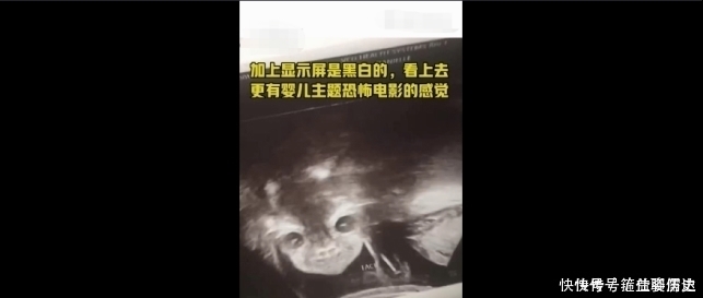 b超|孕妇做B超被吓坏,孩子突然睁眼怪笑!医生却说……