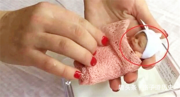 宝宝|14年前,那个打破吉尼斯世界纪录的“拇指宝宝”,后来怎样了