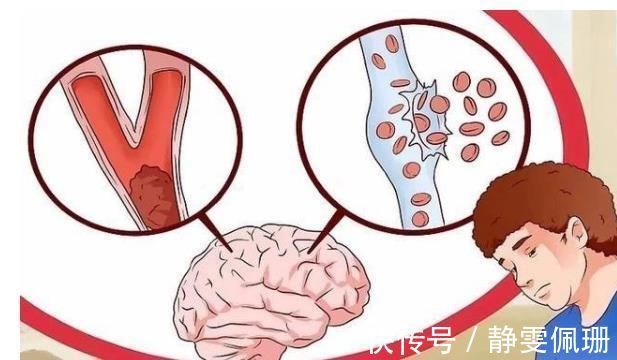 心脑血管|预防脑梗，睡前经常做这一件事，能够帮你疏通血管，避免中风！