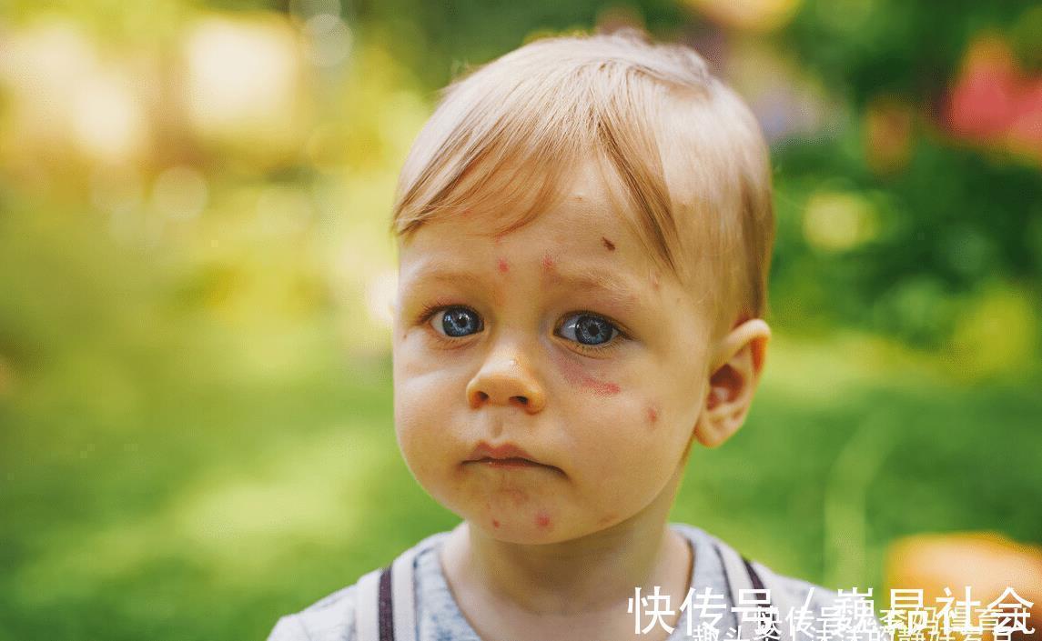 宝宝们|嗡嗡嗡,你听你听,蚊子在狰狞的笑,它最喜欢小宝宝