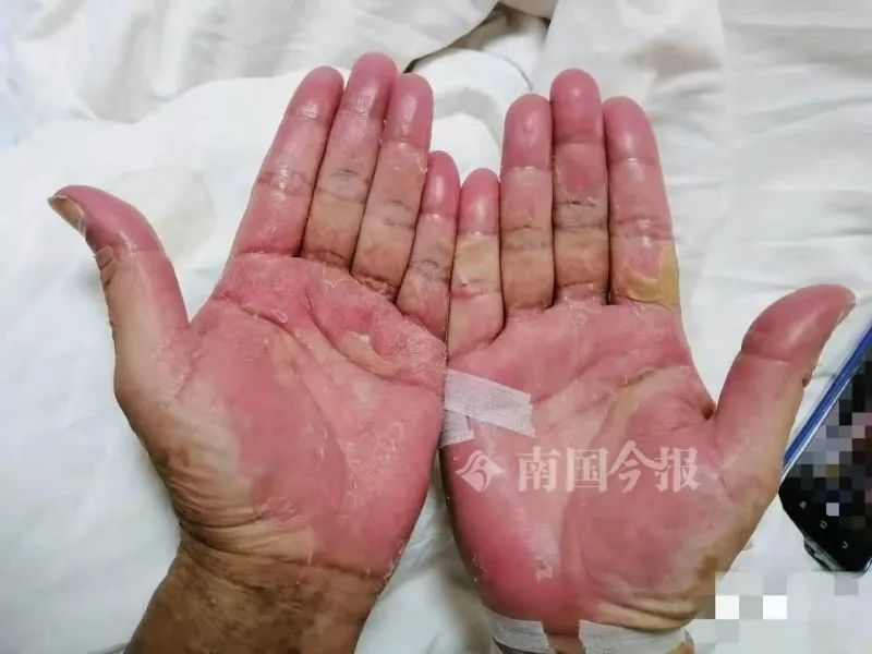 蛇胆+蛇血+蟾蜍+|蛇胆+蛇血+蟾蜍+青蛙生吃下肚，结果…