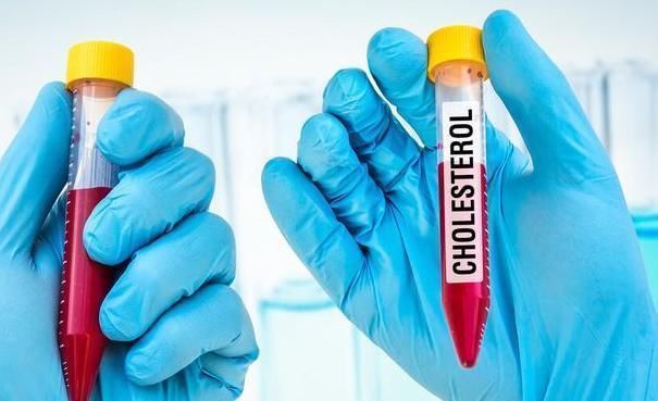 血管|低密度脂蛋白高,“死对头”就在厨房,偶尔吃点,血管不堵有弹性