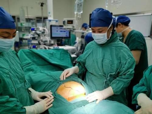 宫外孕|怀孕6个多月,子宫却是空的!孩子去哪儿了?!