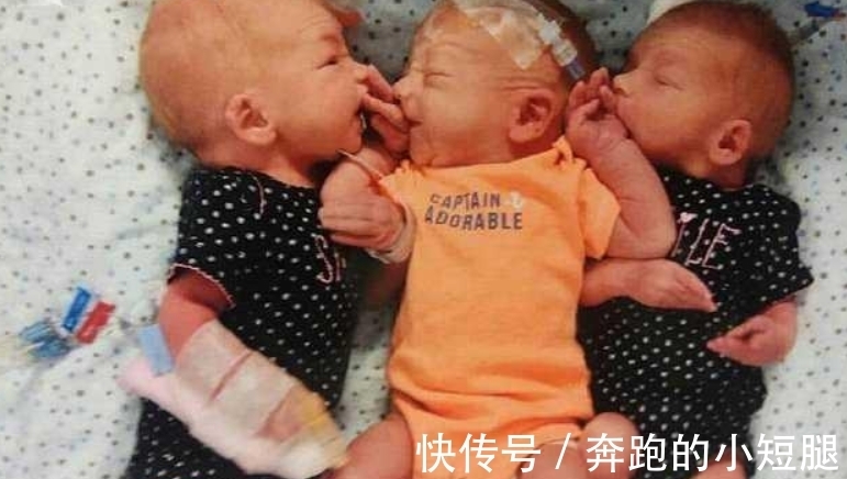 女子|腹痛难忍以为是结石,竟连续生下三胞胎,医生:怀孕34周都不知道