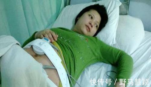 性别|产检两次都是女孩,生下的却是男孩,为啥会出现“女翻男”的情况