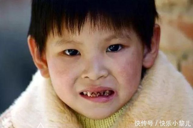 手指套|2岁孩子有了小黑牙,可能和糖果无关,跟爸妈的这些坏习惯有关