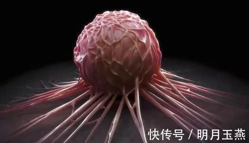 婦科炎癥|約9成女性害怕絕經，其實絕經并非全無好處，4個好處“不請自來”