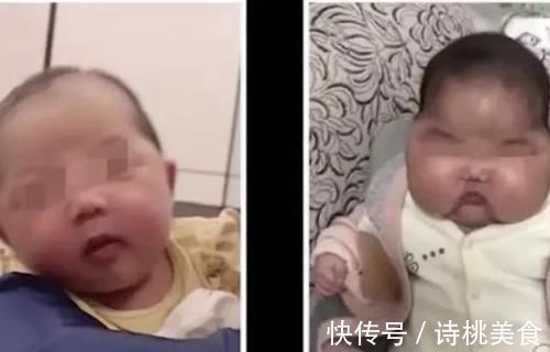 大头娃|中国各地出现大头娃,是什么原因造成的,应该如何惩治?