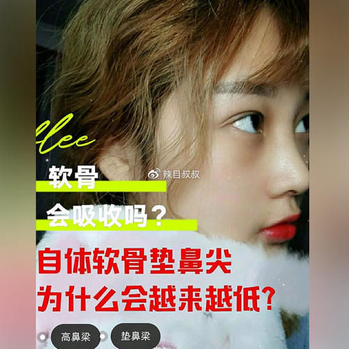 自体软骨垫鼻尖为什么会越来越低？