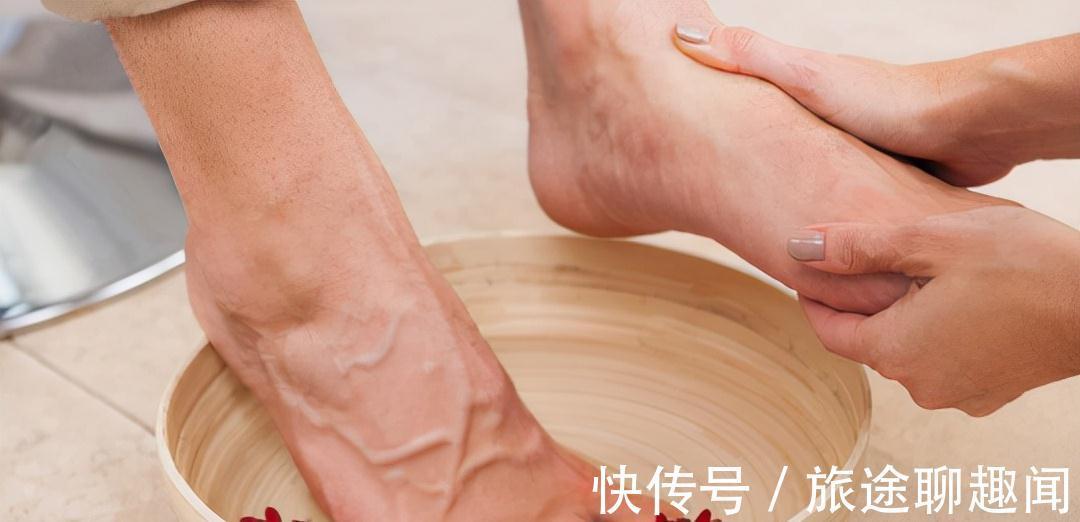 泡脚|天天用热水泡脚,到底是养生还是慢性自杀?5种人坚决不能泡脚