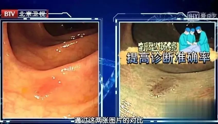 症状|这种癌症每年致死近30万人，隐匿症状需警惕！