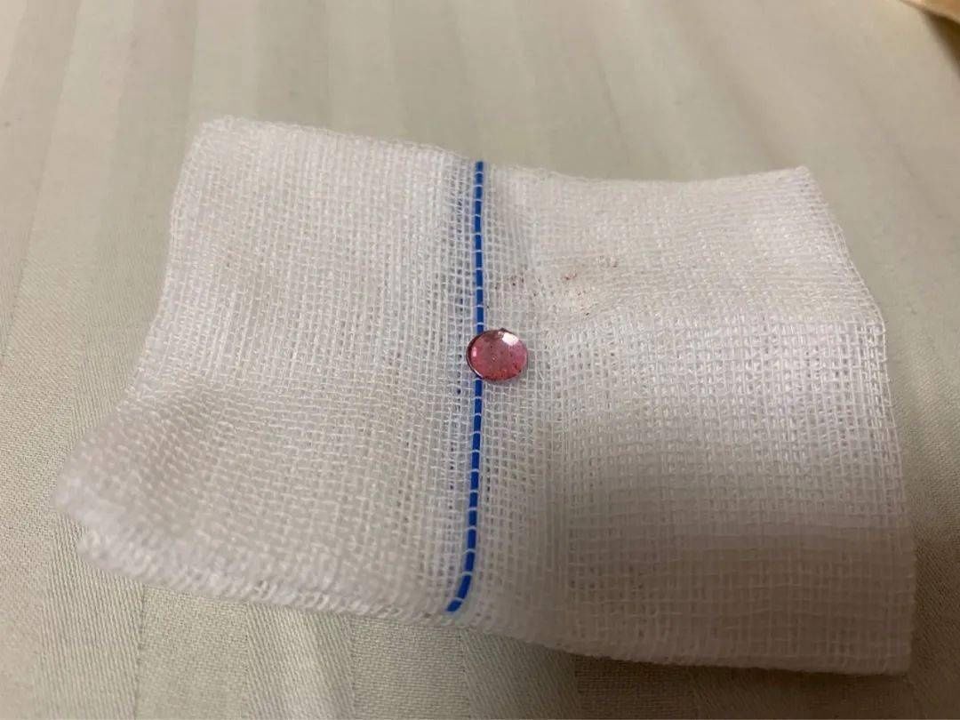 妈妈，我听不见！灯光一打，6岁男童耳朵里竟然反光，母亲惊呆……