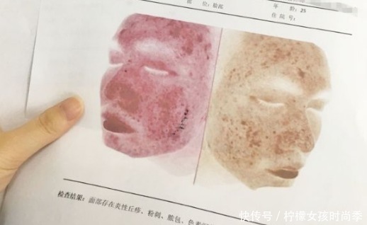 差评|祛痘好物分享,公认“零差评”的祛痘好物,每一款都是性价比之王