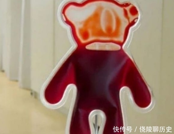 中国|全世界最稀有的 “3大血型”,熊猫血不算啥,第3种仅中国有!