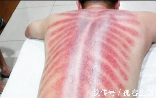 刮痧|女人常刮痧,回到18!中医教你刮一穴,治一病!调整经气,增加免疫