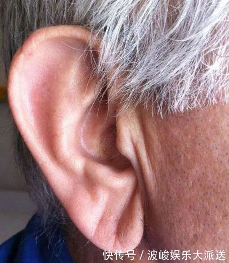 ep血脂高不高,看脸上三个地方就知道,降血脂四种食物一口别吃