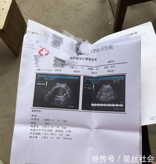 幸孕姐|18岁女孩怀孕43周还没生,B超结果出来后,全家人都紧张了一番