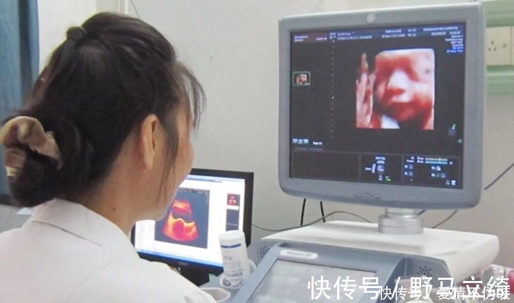 鉴定|一张四维彩超轻松看出胎儿性别,孕妈先别高兴的太早